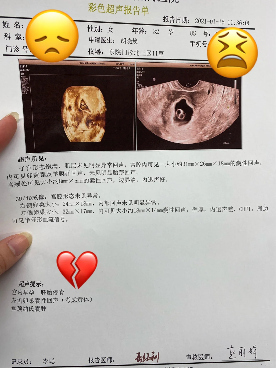 <b>9周+胎停，放不下的爱……（1）,国内代孕机构咨询</b>