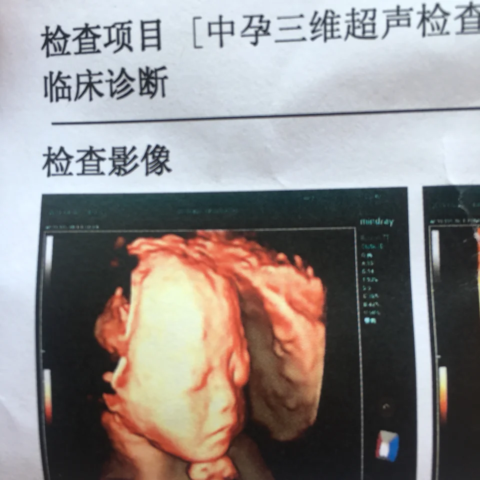 <b>第二次失去做母亲的权利,代孕得花多少钱啊</b>