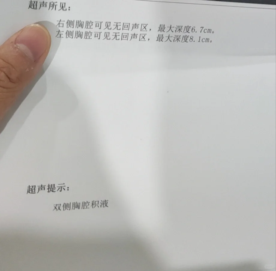 <b>移植后第12/13天，胸腹水加重,代孕机构哪些好,国内龙凤胎可以做吗</b>